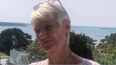 Sylvia C. · 81 · Sun damage cleared