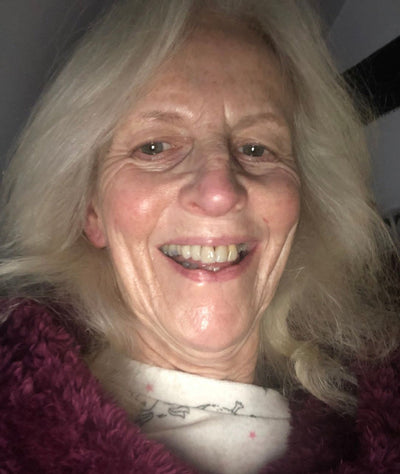 Dorothy B. · Sun damage fading
